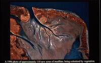 Mississippi Delta Wetland Creation thumbnail