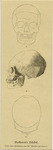 Beethoven's Schädel thumbnail