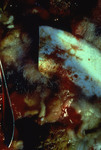 Untitled, #237 thumbnail