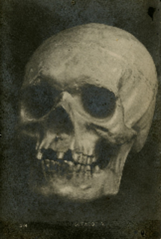 Beethoven's skull thumbnail
